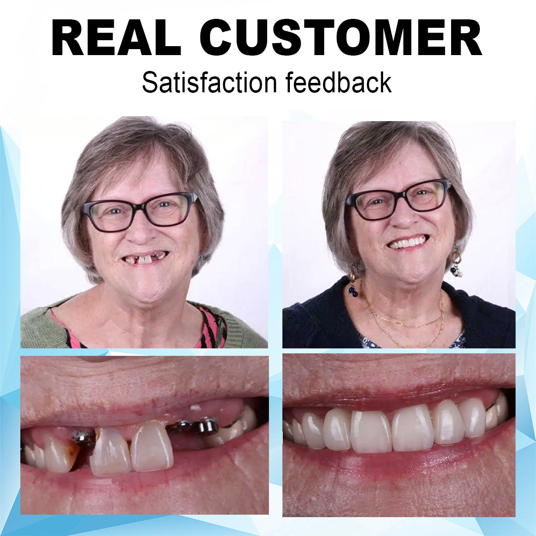Dobshow ™ Silicone Reline Denture Set(⏰Limited time discount Last 30 minutes⏰)
