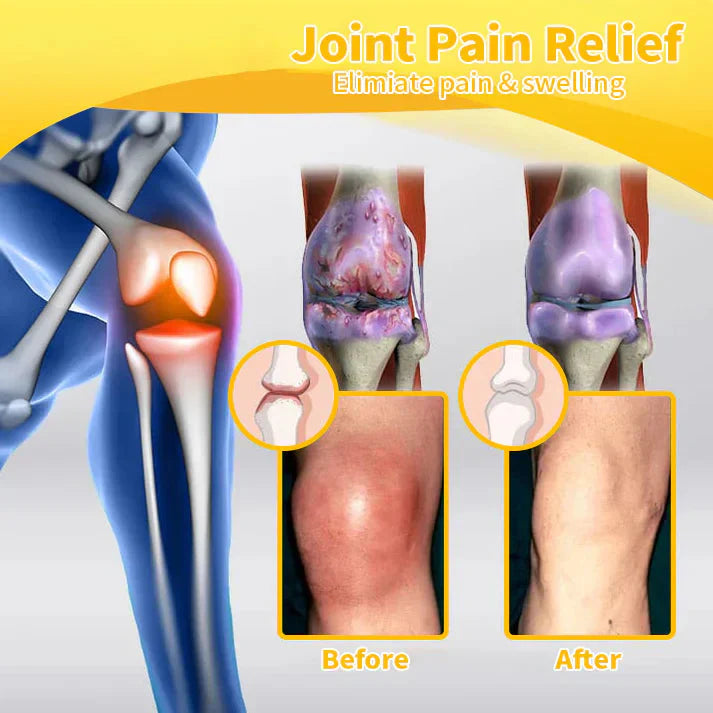 ✅Official Store: Dobshow™ Bee-Venom Pain-Relief Bone Healing Cream👨⚕️Orthopaedic Association(AOA) Approved (Reducing joint swelling, pain, stiffness, redness, warmth, soreness, and joint fatigue)