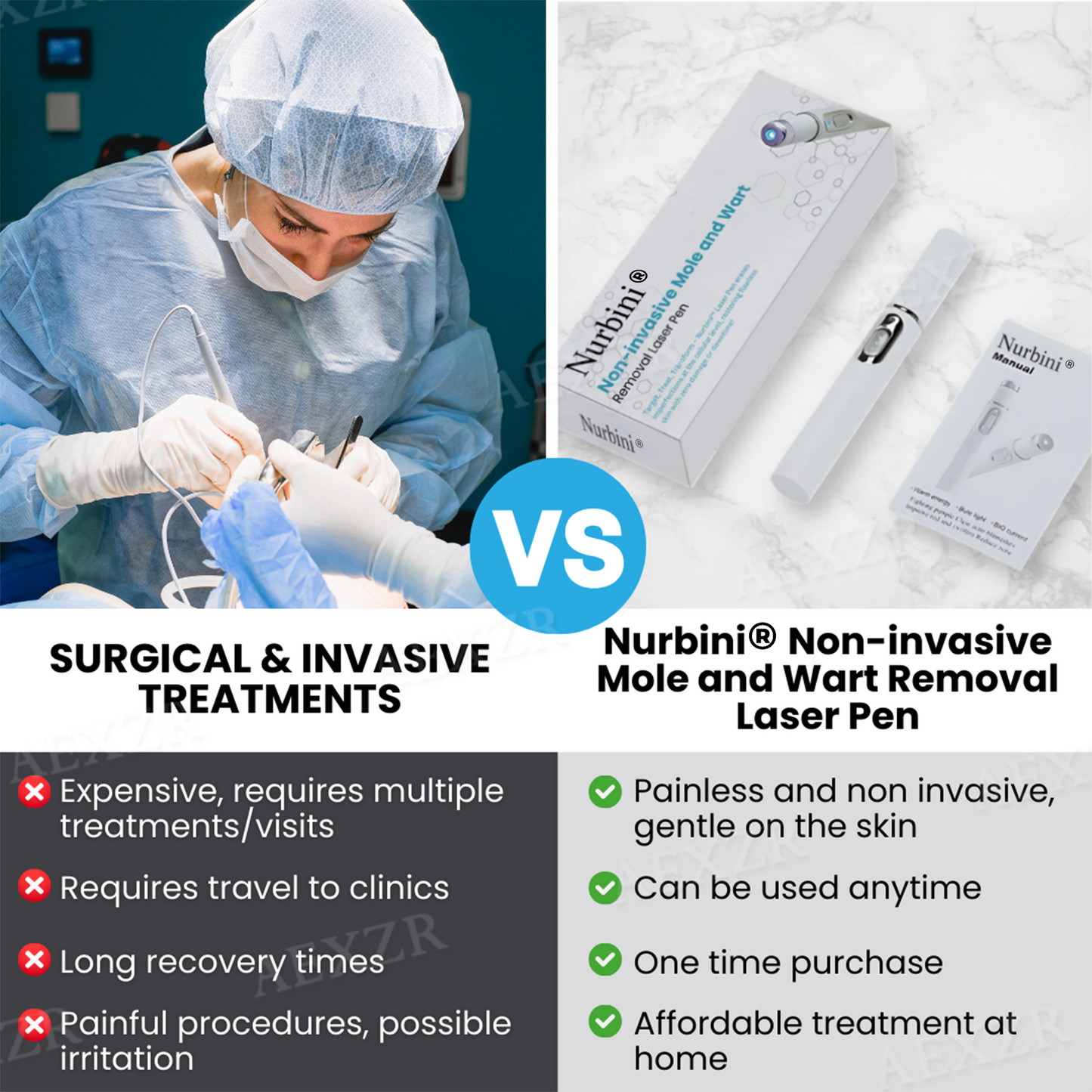 ✨Nurbini® Non-invasive Mole and Wart Removal Laser Pen✨