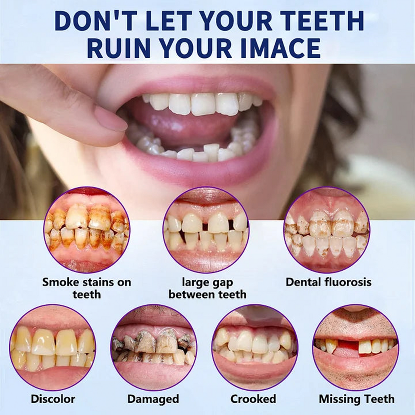 š¦·NurbiniĀ®Advanced Customized Full Denture Set >>ā
70% OFF