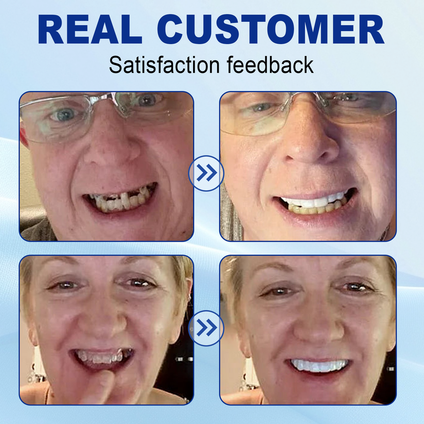 š¦·NurbiniĀ®Advanced Customized Full Denture Set >>ā
70% OFF