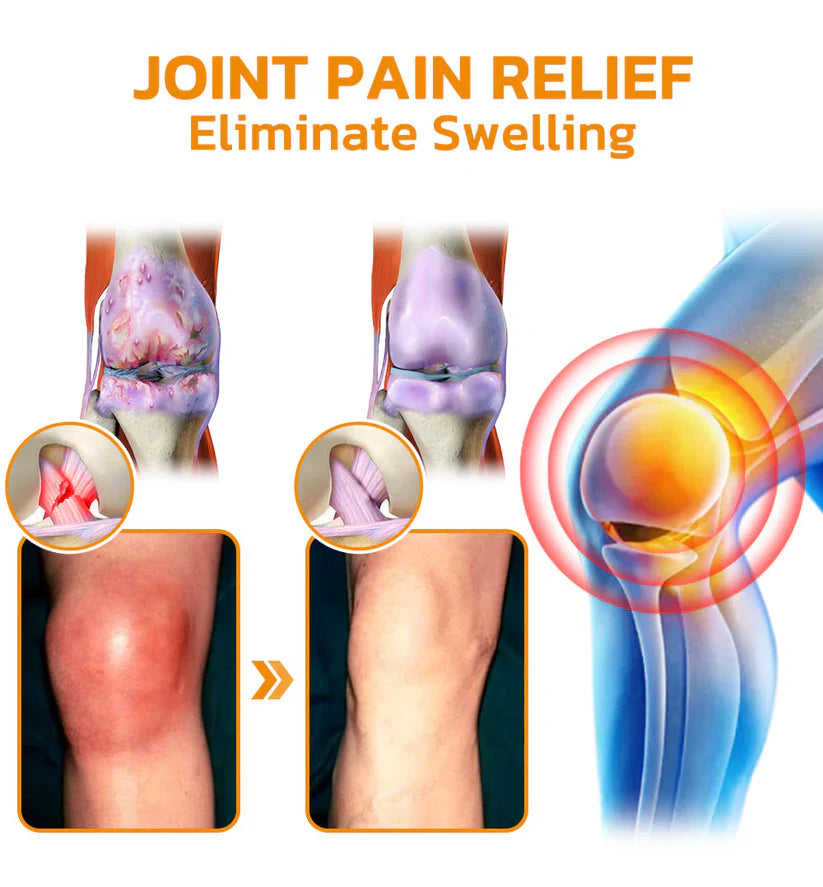 ✅Official Store: Dobshow™ Bee-Venom Pain-Relief Bone Healing Cream👨⚕️Orthopaedic Association(AOA) Approved (Reducing joint swelling, pain, stiffness, redness, warmth, soreness, and joint fatigue)