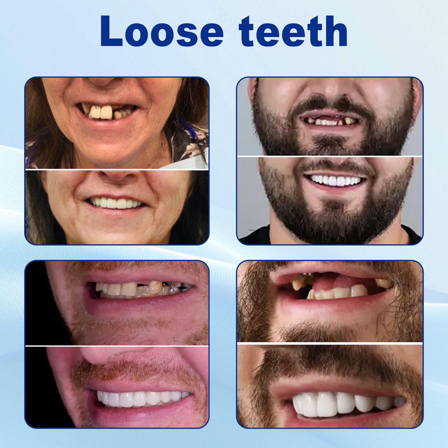 š¦·NurbiniĀ®Advanced Customized Full Denture Set >>ā
70% OFF