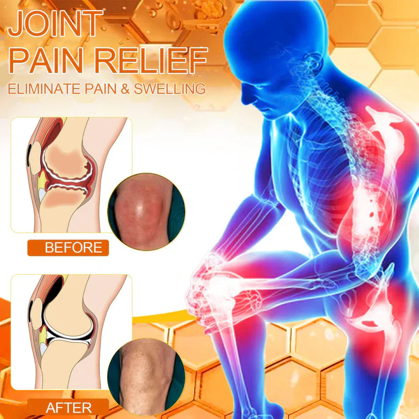 ✅Official Store: Dobshow™ Bee-Venom Pain-Relief Bone Healing Cream👨⚕️Orthopaedic Association(AOA) Approved (Reducing joint swelling, pain, stiffness, redness, warmth, soreness, and joint fatigue)