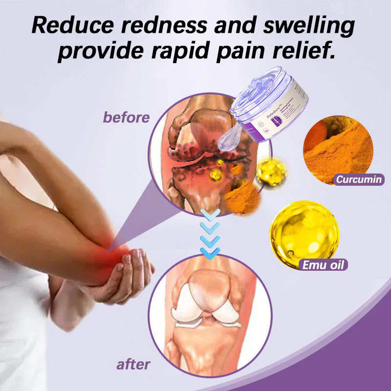 Dobshow™ Joint Pain Treatment Gel – Turmeric Extract&Emu Oil 👨⚕️𝑨𝒖𝒔𝒕𝒓𝒂𝒍𝒊𝒂𝒏 𝑶𝒔𝒕𝒆𝒐𝒑𝒂𝒕𝒉𝒊𝒄 𝑨𝒔𝒔𝒐𝒄𝒊𝒂𝒕𝒊𝒐𝒏 (𝑨𝑶𝑨)𝑨𝒑𝒑𝒓𝒐𝒗𝒆𝒅
