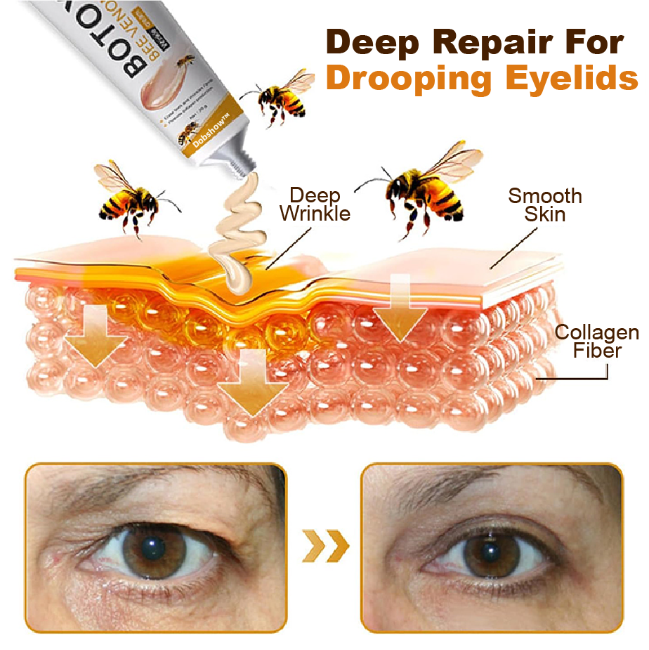 đ¨Limited Time Offer: Dobshow⢠Botox Bee Venom Anti-Wrinkle Creamđđ -- Rapid Anti-Aging Solution