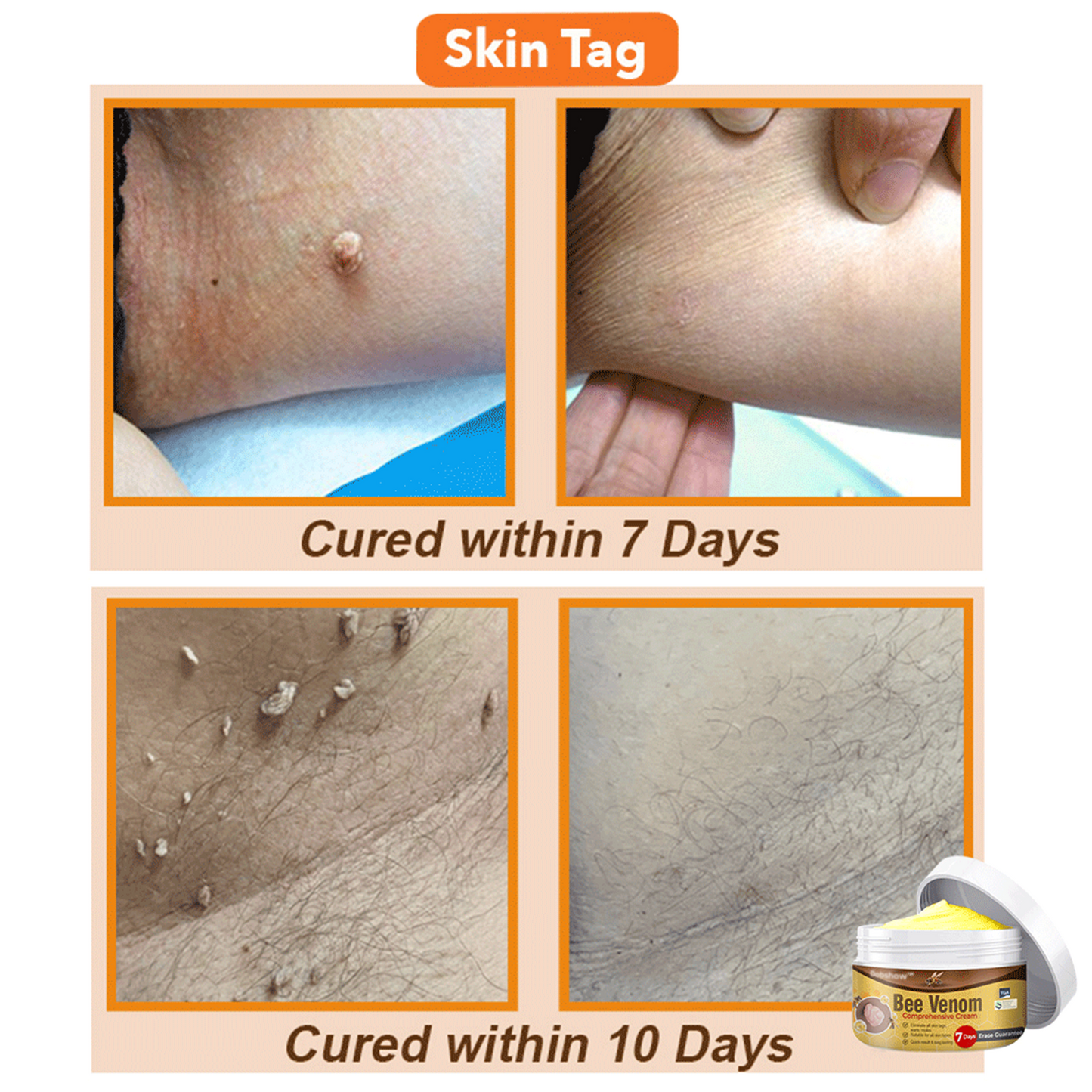 💞 Dobshow™ Bee Venom Comprehensive Skin Treatment Cream 🇦🇺 Dermatologist Recommended ✅