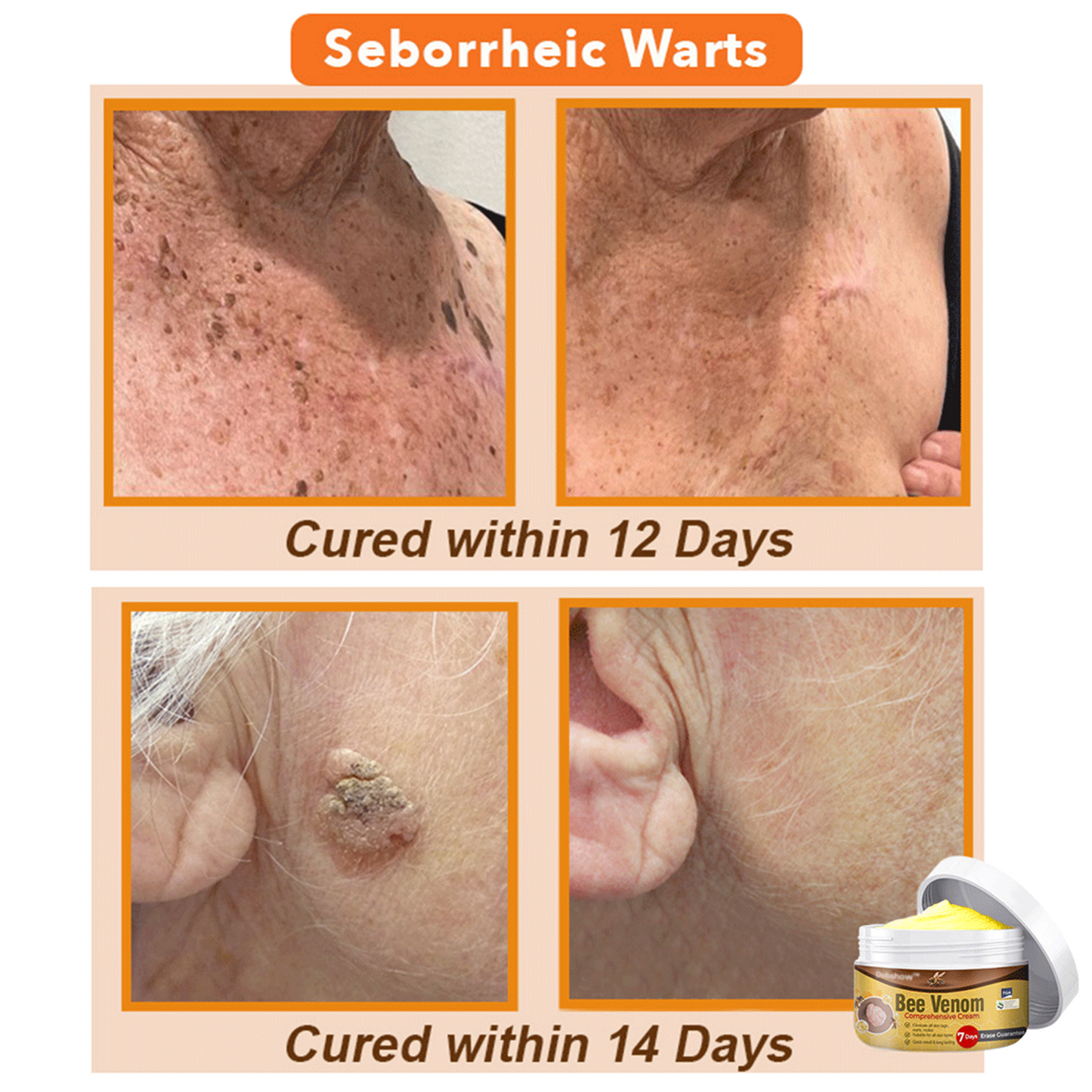 💞 Dobshow™ Bee Venom Comprehensive Skin Treatment Cream 🇦🇺 Dermatologist Recommended ✅