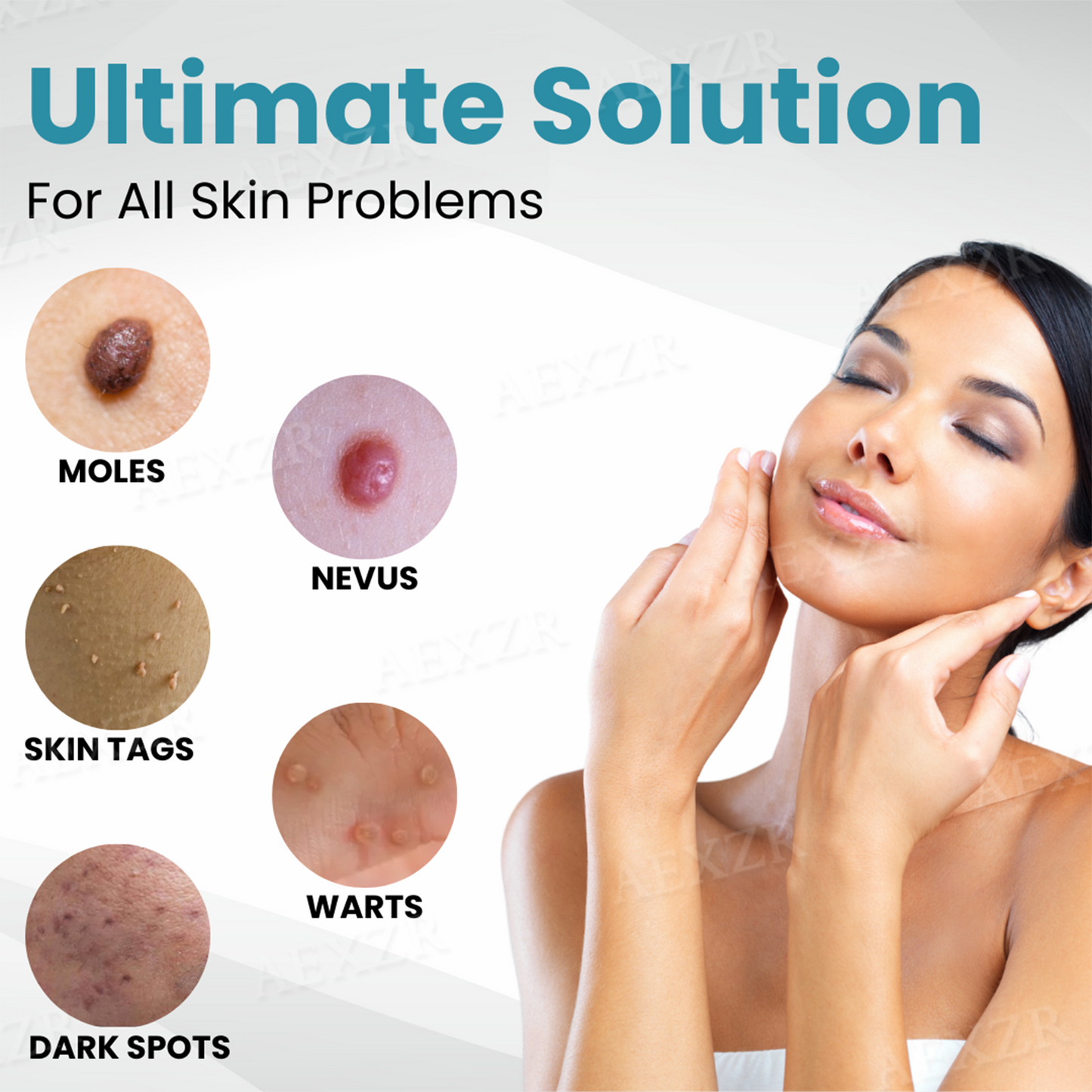 ✨Nurbini® Non-invasive Mole and Wart Removal Laser Pen✨