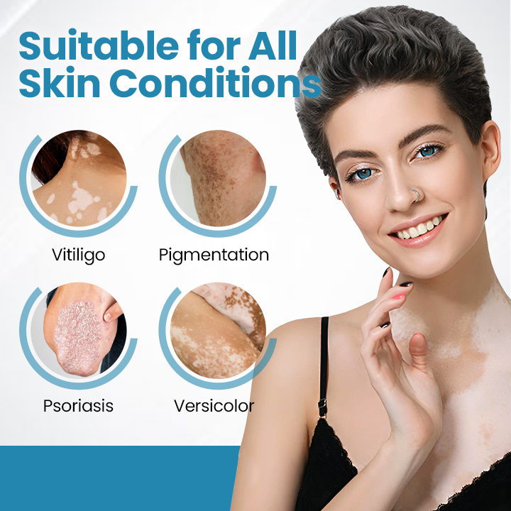 Nurbini® DermaBeam Vitiligo Therapy device