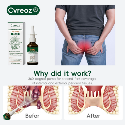 𝗖𝘃𝗿𝗲𝗼𝘇® 𝗙𝗮𝘀𝘁 𝗛𝗲𝗺𝗼𝗿𝗿𝗵𝗼𝗶𝗱 𝗣𝗥𝗢 𝗦𝗽𝗿𝗮𝘆