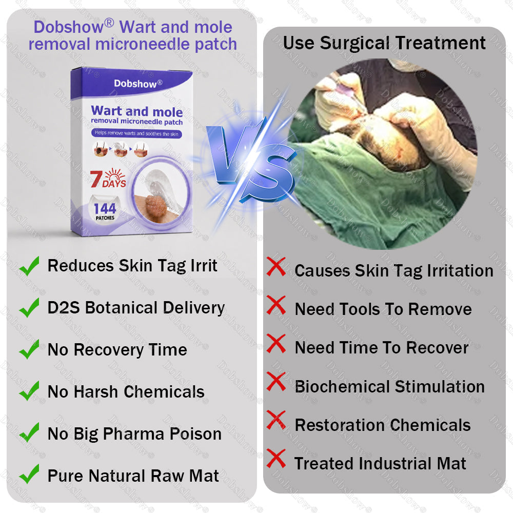 𝗗𝗼𝗯𝘀𝗵𝗼𝘄® 𝗪𝗮𝗿𝘁 𝗮𝗻𝗱 𝗺𝗼𝗹𝗲 𝗿𝗲𝗺𝗼𝘃𝗮𝗹 𝗺𝗶𝗰𝗿𝗼𝗻𝗲𝗲𝗱𝗹𝗲 𝗽𝗮𝘁𝗰𝗵