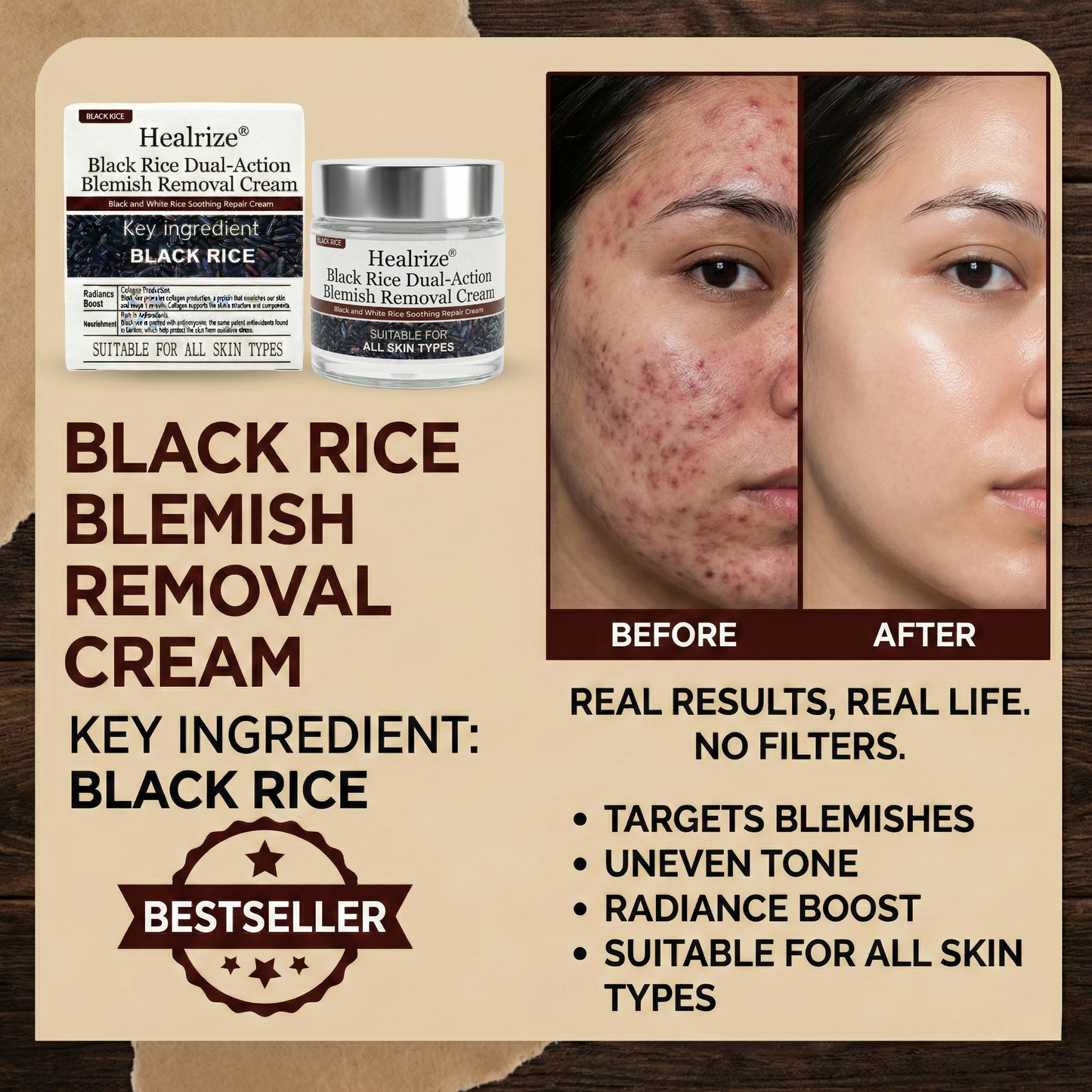 🏅𝙏𝙂𝘼 𝘼𝙥𝙥𝙧𝙤𝙫𝙚𝙙 | Healrize® Black Rice Dual-Action Blemish Removal Cream