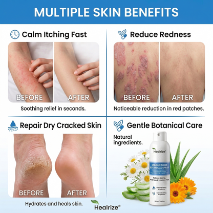 ✅ Official Store | Healrize® Magnesium Botanical Spray – Advanced Skin Recovery for Psoriasis & Eczema | Rapid Soothing, Steroid-Free