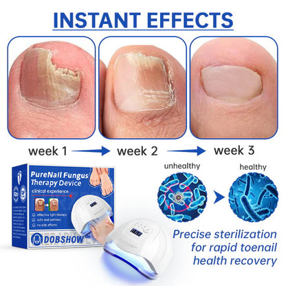 Dobshow™ PureNail Fungus Laser Therapy Device