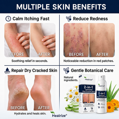 🔥56K+SOLD🔥Healrize® 2-in-1 Liposomal Mag-Ceramide Spray | 2-Min Rapid Relief for Psoriasis & Eczema (Full Body & Intimate Safe)