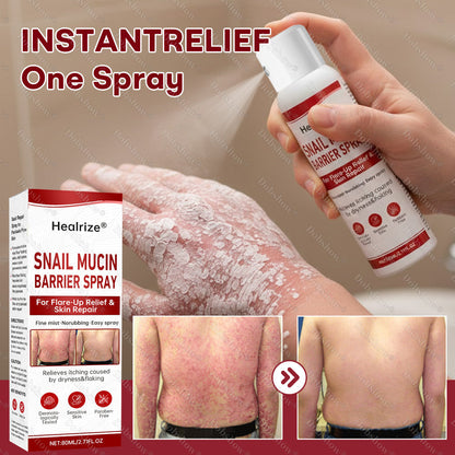 🔥𝙈𝙖𝙧𝙘𝙝 𝙎𝙥𝙚𝙘𝙞𝙖𝙡 𝙊𝙛𝙛𝙚𝙧𝙨 | Healrize® Snail Mucin Barrier Spray for Flare-Up Relief & Skin Repair