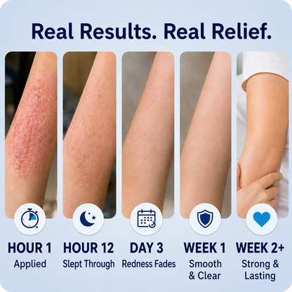 🔥56K+SOLD🔥Healrize® 2-in-1 Liposomal Mag-Ceramide Spray | 2-Min Rapid Relief for Psoriasis & Eczema (Full Body & Intimate Safe)