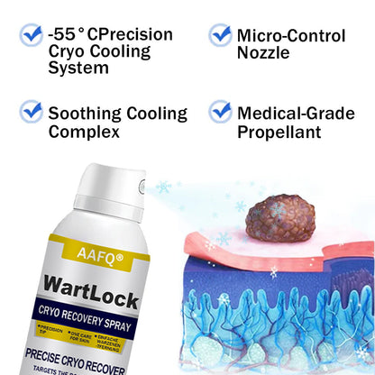 🎅 𝘾𝙝𝙧𝙞𝙨𝙩𝙢𝙖𝙨 𝙎𝙖𝙡𝙚 | AAFQ® WartLock CRYO RECOVERY SPRAY