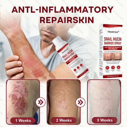 🔥𝙈𝙖𝙧𝙘𝙝 𝙎𝙥𝙚𝙘𝙞𝙖𝙡 𝙊𝙛𝙛𝙚𝙧𝙨 | Healrize® Snail Mucin Barrier Spray for Flare-Up Relief & Skin Repair
