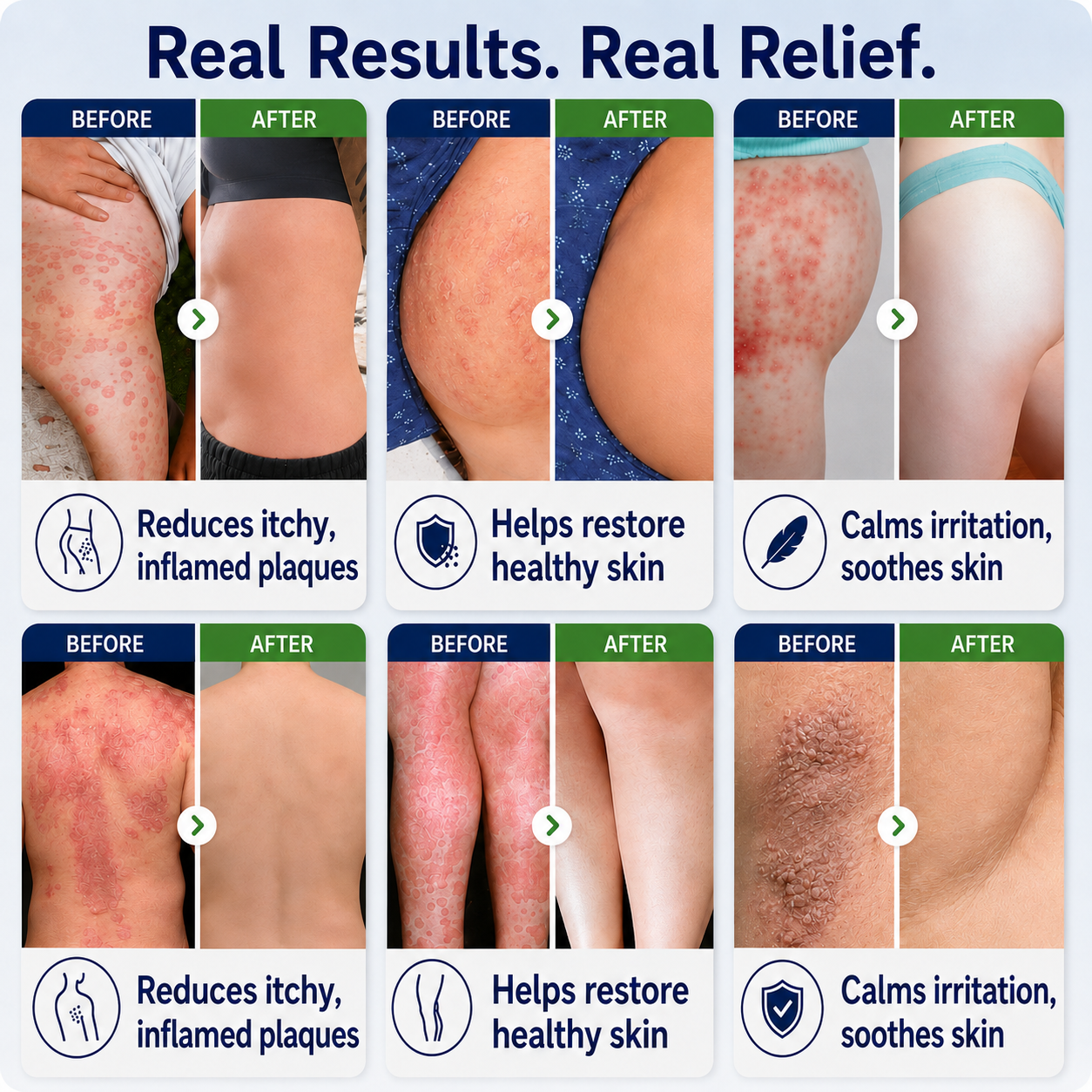 🔥56K+SOLD🔥Healrize® 2-in-1 Liposomal Mag-Ceramide Spray | 2-Min Rapid Relief for Psoriasis & Eczema (Full Body & Intimate Safe)
