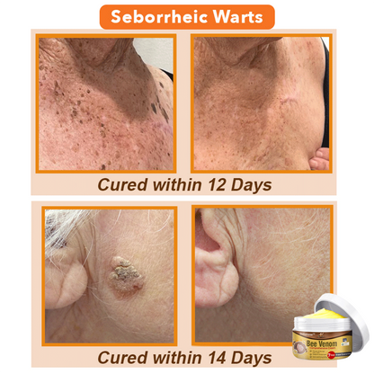 💞  Dobshow™ Bee Venom Comprehensive Skin Treatment Cream 🇦🇺 Dermatologist Recommended ✅