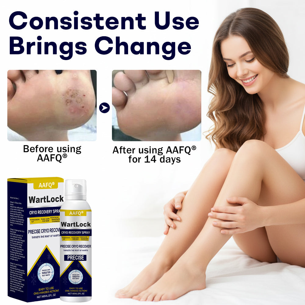 🎅 𝘾𝙝𝙧𝙞𝙨𝙩𝙢𝙖𝙨 𝙎𝙖𝙡𝙚 | AAFQ® WartLock CRYO RECOVERY SPRAY