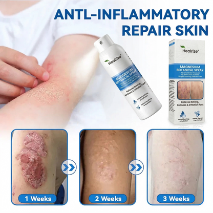 ✅ Official Store | Healrize® Magnesium Botanical Spray – Advanced Skin Recovery for Psoriasis & Eczema | Rapid Soothing, Steroid-Free