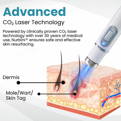 ✨Nurbini® Non-invasive Mole and Wart Removal Laser Pen✨
