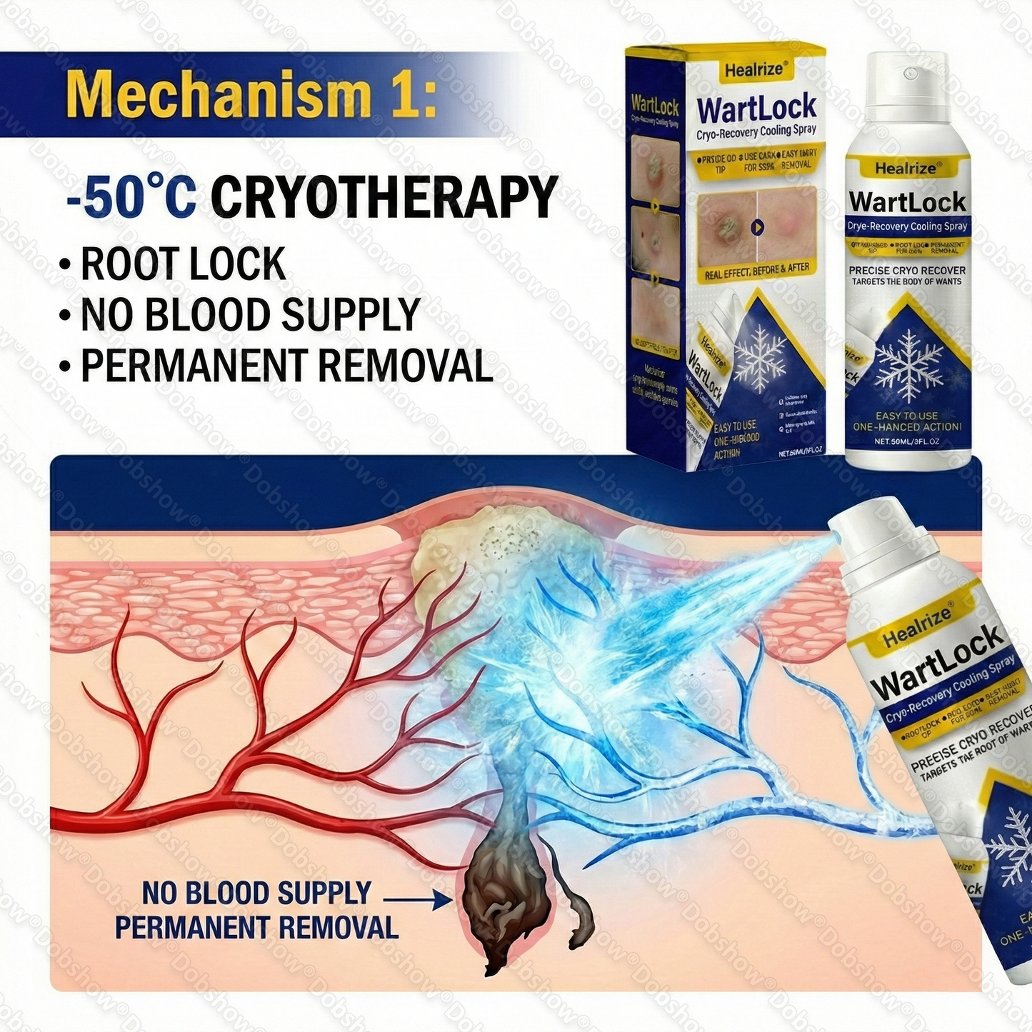 ❄️Healrize® WartLock Cryo-Recovery Cooling Spray❄️