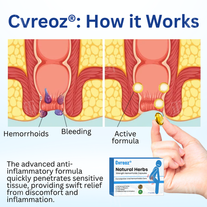 𝐂𝐯𝐫𝐞𝐨𝐳® 𝐍𝐚𝐭𝐮𝐫𝐚𝐥 𝐇𝐞𝐫𝐛𝐬 𝐒𝐭𝐫𝐞𝐧𝐠𝐭𝐡 𝐇𝐞𝐦𝐨𝐫𝐫𝐡𝐨𝐢𝐝𝐬 𝐂𝐚𝐩𝐬𝐮𝐥𝐞𝐬
