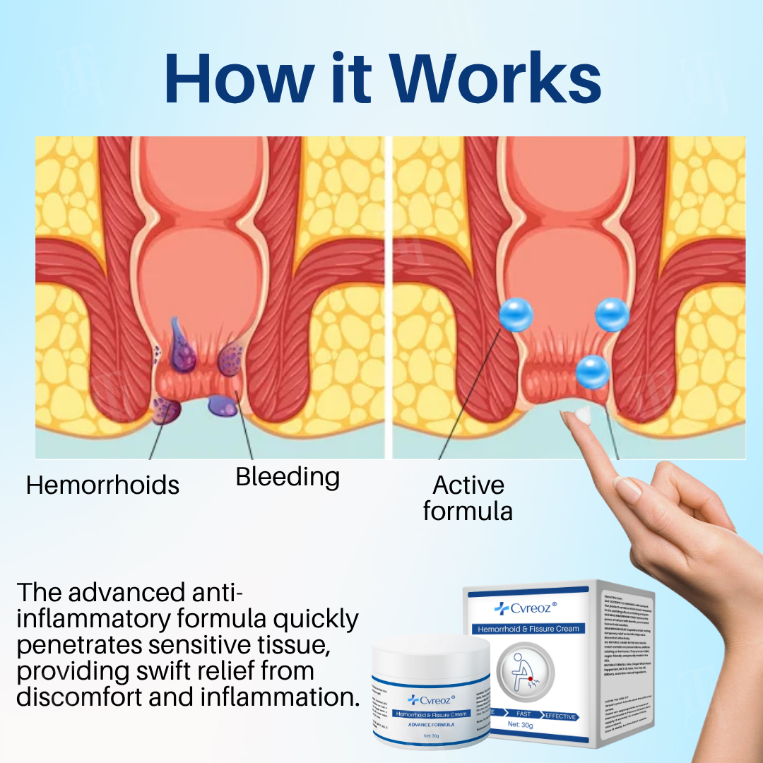 Healrize® Hemorrhoid & Fissure Cream